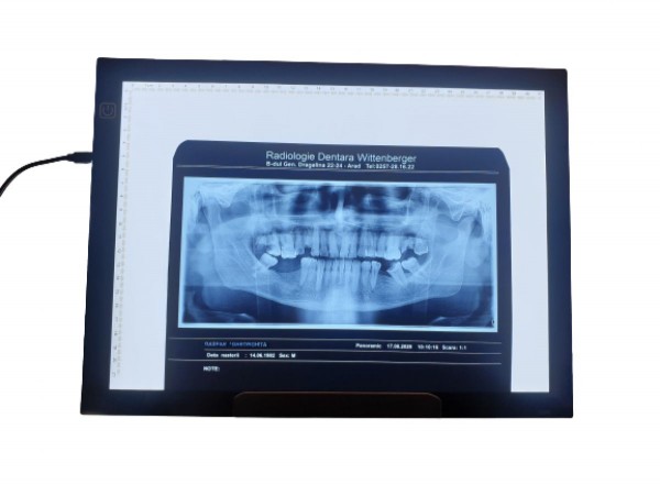 Negatoscop radiografii dentare A4USB
